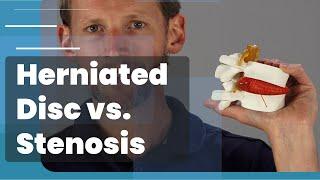 Herniated Disc VS Lumbar Stenosis