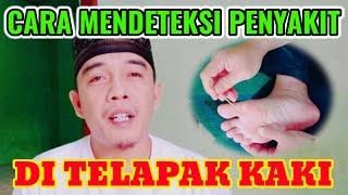 CARA MENDETEKSI PENYAKIT | DI TELAPAK KAKI