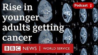 Why are more adults than ever getting cancer younger? - The Global Story podcast, BBC World Service