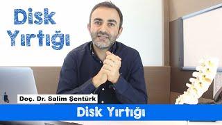 Disk Yırtığı - Bel Kemiği Arasındaki Disklerin Yırtılması Nelere Neden Olur - Doç. Dr. Salim Şentürk