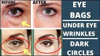 FACE YOGA FOR EYE BAGS, EYE WRINKLES, DARK CIRCLES | FACE MASSAGE for EYE BAGS