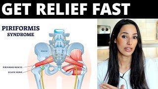 7 Piriformis Syndrome Tips to Get FAST Relief (No Exercises or Stretches)