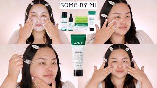 SOME BY MI ACNE SKINCARE REVIEW AHA BHA PHA MIRACLE | STYLEVANA