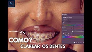 Como Clarear os Dentes No Photoshop