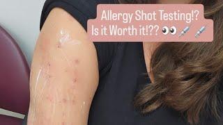 Allergy Shots!  HOW DO THEY WORK??? AND ARE THEY WORTH IT!?? Let's find out!!  #allergyseason