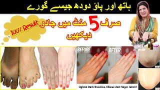 INSTANT HANDS, FEET, KNUCKLES WHITENING in 5 MINUTES in URDU / HINDI | DR BILQUIS SHAIKH