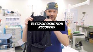 Vaser Liposuction Recovery