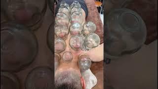 [ASMR] Chinese Cupping Therapy  #asmr #cupping #massage #china #youtubeshorts