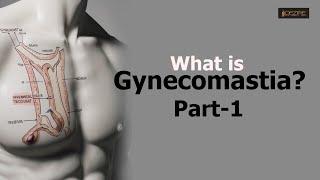 What is Gynecomastia ?? Part1 @gynoguygaurav