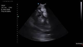 Sheep Pregnancy Ultrasound Scan Images