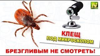 [Natalex] Клещ под микроскопом...