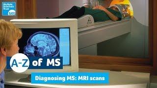 Diagnosing MS - MRI scan