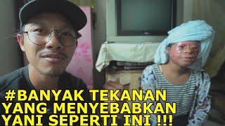 OPERASI MUKA YANI YG KEB4KAR KARNA LEM