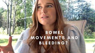 WHAT IS BOWEL ENDOMETRIOSIS?? WARNING SIGNS AND SYMPTOMS | Diagnosis and Treatment | ENDOEMMM