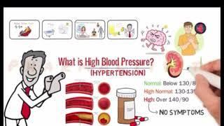 Simple steps to lower Blood Pressure