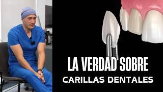  Carillas dentales: ¿Negocio o Salud?