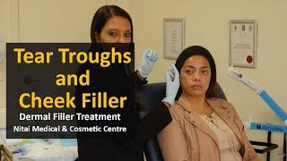 Dermal Filler Treatment Melbourne  - Nitai Medical & Cosmetic Centre (03) 9300 1244