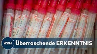 CORONAVIRUS IST WÄHLERISCH: SARS-CoV-2-Virus kann eine Blutgruppe gar nicht leiden