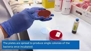 Microbiology - Blood culture