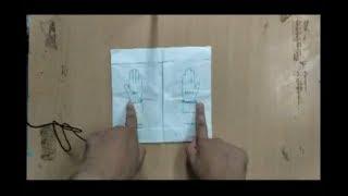 How to wear sterile gloves (Hindi)