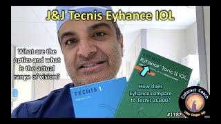 CataractCoach 1182: the J&J Vision Tecnis Eyhance IOL lens implant for cataract surgery