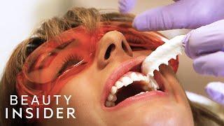 The Fastest Way Dentists Whiten Teeth | Beauty Explorers | Beauty Insider