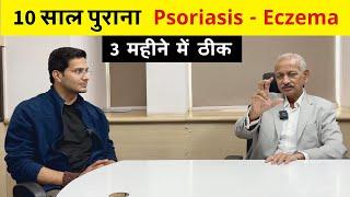 Psoriasis Eczema Treatment Ft. Dr. Mahendra Kabra | Homeopathy | Skin Disease | Himanshu Bhatt