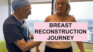 REAL PATIENTS REAL STORIES: Breast Reconstruction Journey & the Importance of Breast Preservation