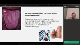 Андрей Финкельштейн - Заболевания слизистой оболочки полости рта в повседневной практике стоматолога