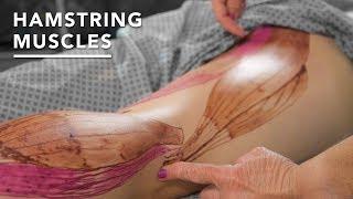 Massage Techniques for Hamstring Injuries