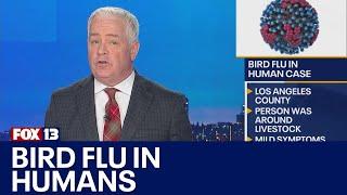 Bird flu in a human confirmed in CA