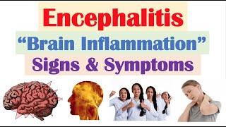 Encephalitis (“Brain Inflammation”) Signs and Symptoms (& Why They Occur)
