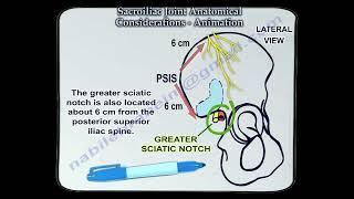 Sacroiliac Joint anatomy and its surrounding structures, a key to understanding low back pain