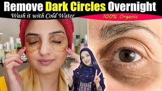 My Friend Told me a Remedy  Remove Dark Circles Fast 100% Permanently at Home