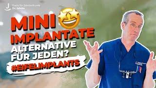 Alternative zu herkömmlichen Implantaten | Mini-Implantate - Für wen sind sie geeignet?