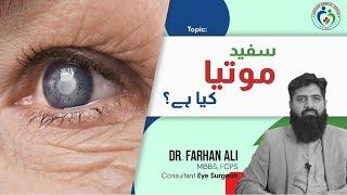 What is white Cataract in Urdu | Understanding White Cataract Surgery in Urdu