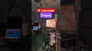 4K Laparoscopic Surgery ? Most Advanced operation theater India ? Hernia Treatment I Surat I Gujarat