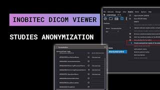 Studies anonymization with Inobitec DICOM Viewer