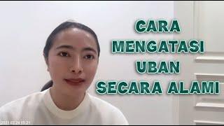 Cara Mengatasi Ubanan Rambut Putih Secara Alami ️Supplement#5️