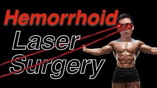 Laser Hemorrhoid Surgery | Dr Chung's POV