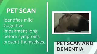 Can a PET scan detect Alzheimer's Disease or Dementia?