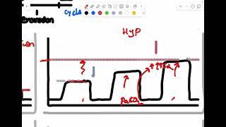 How to Interpret Capnography Waveforms