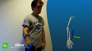 Arm 3D motion analysis with inertial sensors