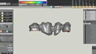 Prótese fixa - 4 elementos - Sistema CAD CAM - In Lab - Software - Zirkonzahn - Talladium do Brasil