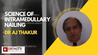 Science of Intramedullary Nailing by Dr AJ Thakur