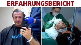 Meine Haartransplantation/Haarverdichtung in Istanbul. Erfahrungsbericht