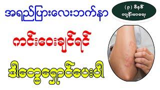 လေးဘက်နာရောဂါအတွက်ဆို မဖြစ်မနေဒါတွေကိုရှောင်ပေးပါ