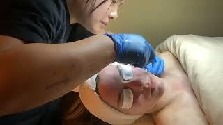 Dermaplane #3 (Nikki Duaban)