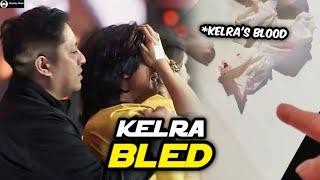 Kelra Actually did Have a NOSEBLEED During Game 5 of M6 Grand Finals and Here's The Reason Why! 