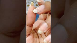 Lets Fix it Broken Nail#theddvlogs#youtubeshorts#nailcare#brokennail#manicure